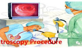 无痛胃镜全过程视频,轻松应对胃部检查